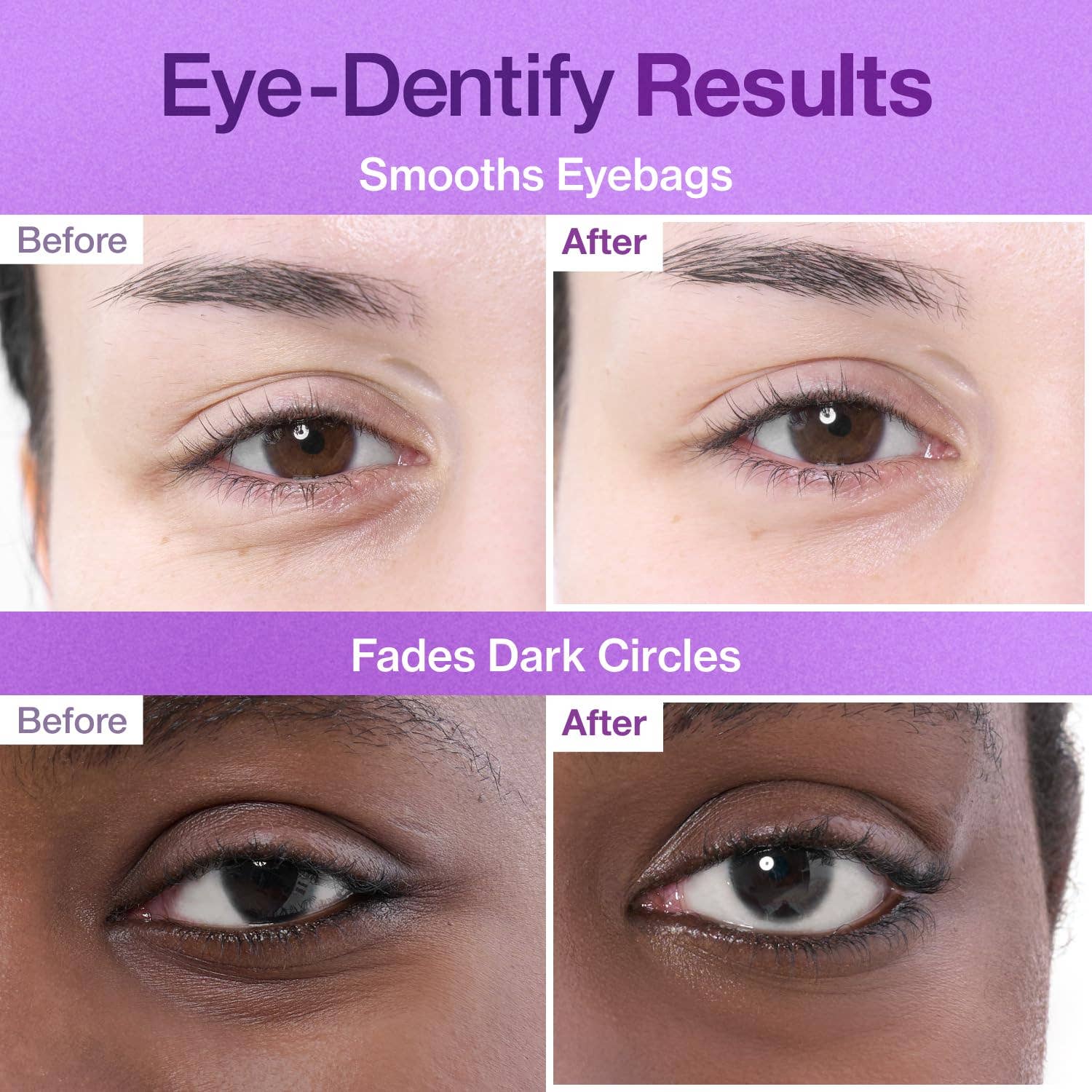 NUMBUZIN No.9 NAD+ Collagen Under Eye Patches 5 Pairs