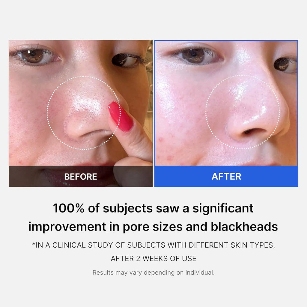 BULK - Medicube Zero Pore Pads 2.0